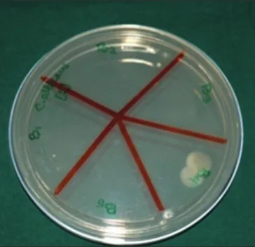 Figure 12: Test Group 2: Candida albicans + apple cider vinegar