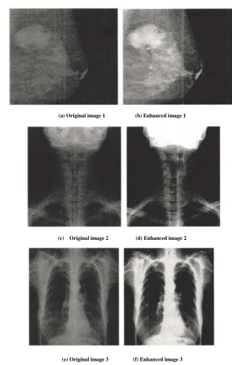 Figure 4.  Enhancement contrast of DR image   