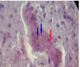 Figure 11: section shows normal tissue and the histopathological  A Photomicrograph of normal rat's brain score =0