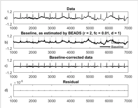 Figure 4 Simulated ECG signal