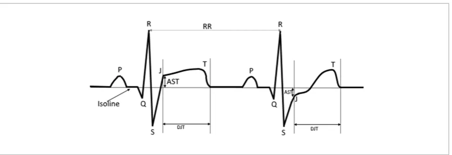 Figure 8 ECG parameters