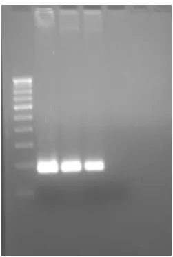 Fig.4: PCR Thermal cycling result for Microbial  testing in ophthalmic solution. Lane 1- Broth, Lane 2- Control, 