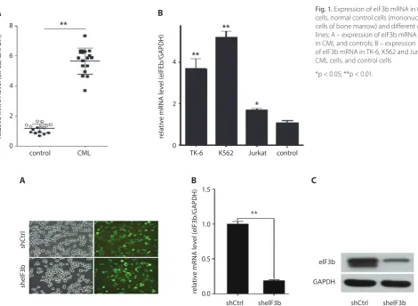 Fig. 1. Expression of eIF3b mRNA in CML cells, normal control cells (mononuclear cells of bone marrow) and different cell lines; A – expression of eIF3b mRNA in CML and controls; B – expression of eIF3b mRNA in TK-6, K562 and Jurkat CML cells, and control cells