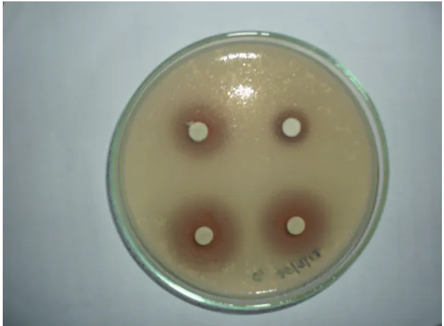 Fig 1 Disc diffusion assay of Terminalia chebula ethanolic extract against clinical isolates of Cryptococcus neoformans  