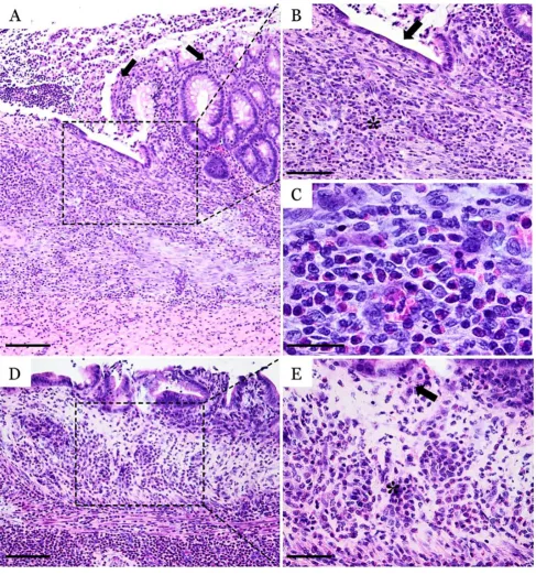 Fig. 3. Histopathological micrographs of TNBS-induced colitis