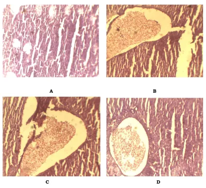 Fig. 1: Histpathological Section of A) CCl4 treated Liver , B) I. coccinea Extract Treated Liver, C) I
