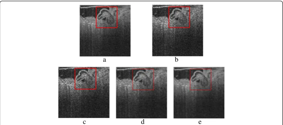 Fig. 7 Recovered OTC images and zoomed square region marked by red-lined boxes via different methods