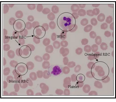 Figure 1: Image of blood sample 