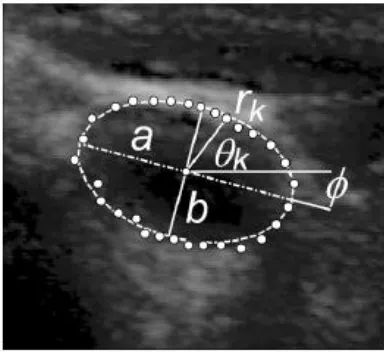 Figure 2.4: Ellipse model for transverse vessel area. The parameters for elliptical model are a, b, ɸ