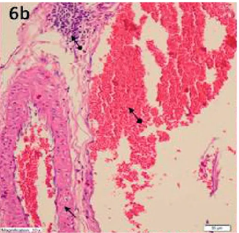 Fig. 6C. A section showing hemorrhage accompanied by glomerular damage (line arrow), diffuse tubular damage, edema (circle arrow), and an interstitial hemorrhage area (square arrow) in the Cis group (H&E, ×400 magnification)
