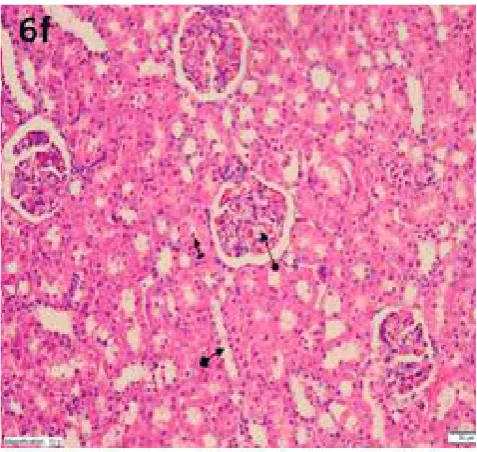 Fig. 6E. A section involving a near-normal appearance (square arrow), mildly persistent tubular irregularities (line arrow) and hemorrhage areas (circle arrow) in the kidney glomeruli of the Cis + ANA50 group (H&E, ×200 magnification)