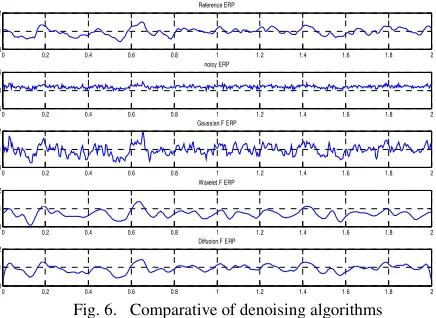 Fig. 6.   Comparative of denoising algorithms 