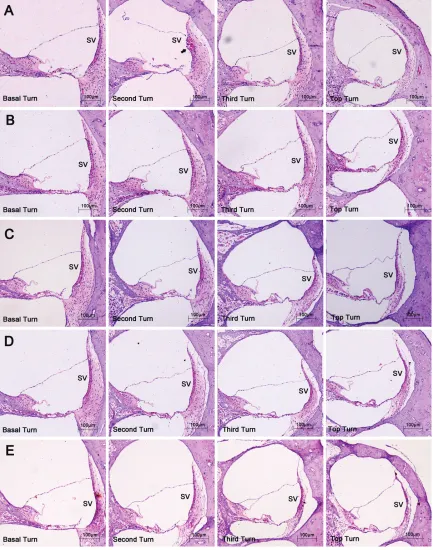 Figure 1. The pathological changes of the inner ear. Haematoxylin-eosin, original magnification ×100