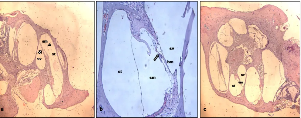 Fig. 1. Light microscopy views of cochlea in the control group, acoustic trauma group, and acoustic trauma+NAC groups