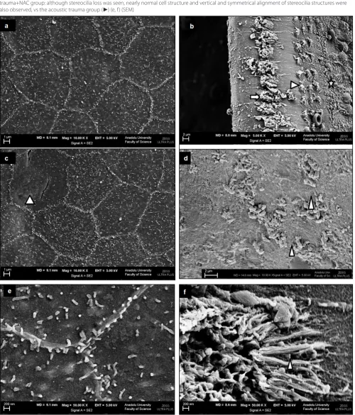 Fig. 2. Scanning electron microscopic (SEM) views of cochlea in the control group, acoustic trauma group, and acoustic trauma+NAC groups