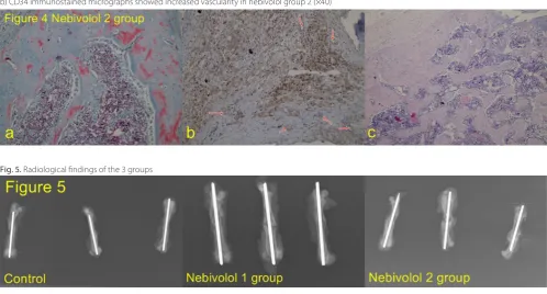Fig. 4. a) Masson’s trichrome and c) hematoxylin & eosin micrographs showed predominantly trabecular bone and less cartilage formation;  b) CD34 immunostained micrographs showed increased vascularity in nebivolol group 2 (×40)