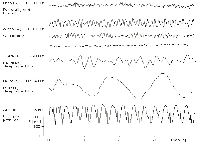 Figure 2.1: EEG rhythms and spikes waves with their frequency bands over time. 