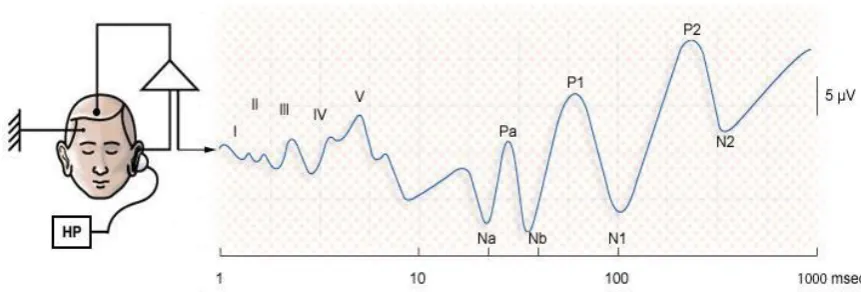 Figure 2.2: Brainstem Evoked Auditory Potentials 