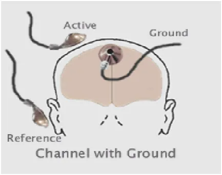 Figure 1.2 Electrode placement systems for EEG measurement 