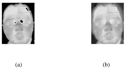 Fig. 3. False detection of eye-frame candidate when: (a) only one inner-canthi was segmented based on temperature, (b) distance between two inner-canthus is larger than one- fth of face-width 