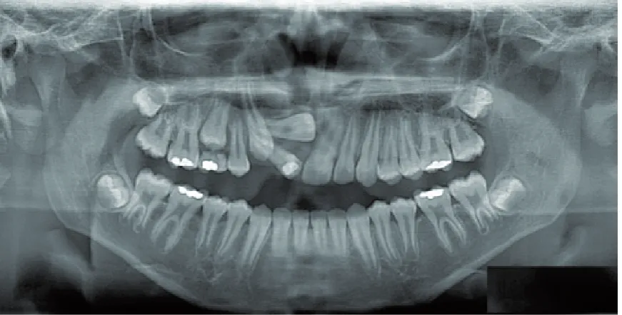 Fig. 3B. Periapical view
