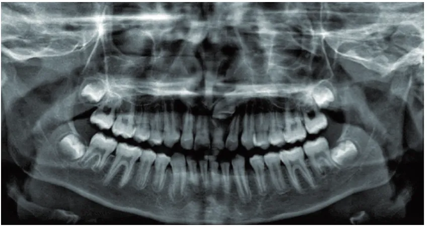 Fig. 4C. Axial and transaxial CBCT views