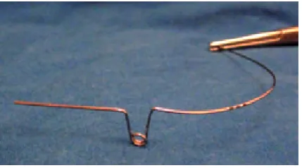 Fig. 4D. Surgical exposure (closed eruption technique) performed by Prof. Arye Shteyer