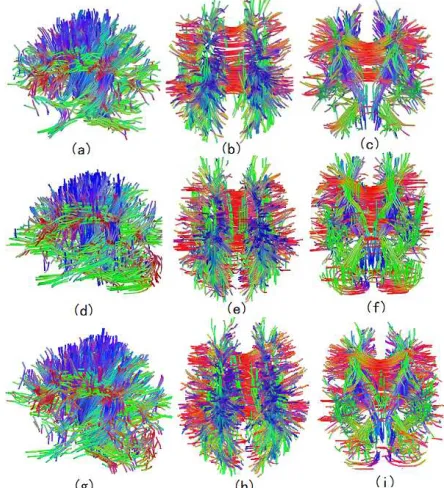 Figure 4 Tracking results within whole brain region, the first low is of DTI, the middle one is of DSI, The third one is of QBI   