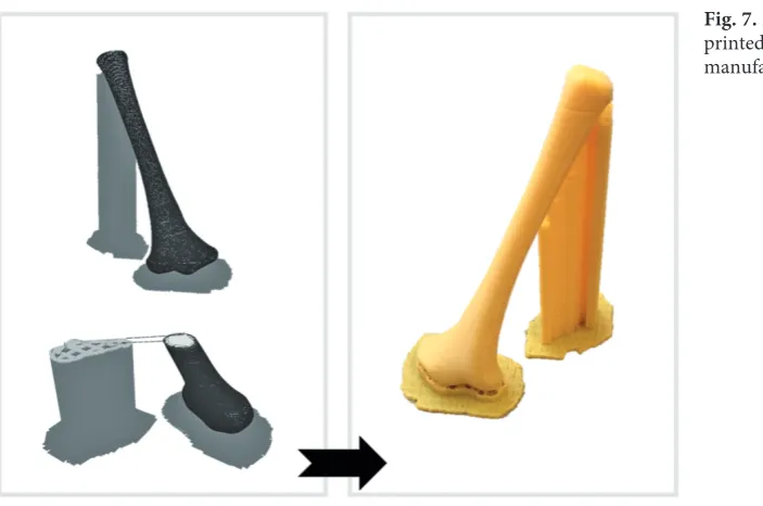 Fig. 8. The Ilizarov apparatus mounted onto bone models printed using FDM additive manufacturing technique