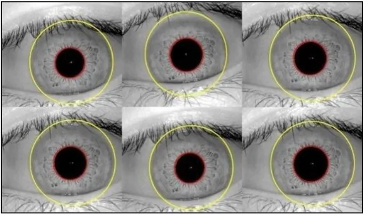 Figure 2.7: Iris Localization (Daugman, 1994) 