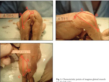 Fig. 1. Characteristic points of magnus gluteal muscle (on the left side)