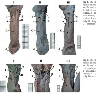 Fig. 1. The triceps brachii muscle in fetuses aged 14 (I), 