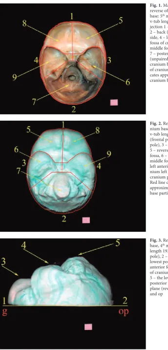 Fig. 1. Material prepared to elicit reverse of female foetus cranium base: 5th month of foetal period, v-tub length 145 mm, down hill pro-jection 1 – front (frontal pole),  2 – back (occipital pole), 3 – right side, 4 – left side, 5 – right anterior fossa 