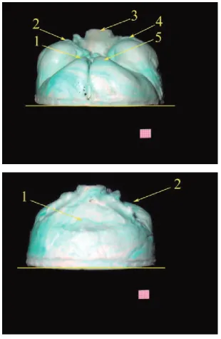 Fig. 4. Reverse of male foetus cra-v-tub length 198 mm, 1 – reverse of cranium left anterior fossa, 2 – reverse of cranium left middle fossa, 3 – reverse of cranium posterior fossa (unpaired), 4 – reverse of cra-nium right middle fossa, 5 – reverse of cran