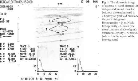 Fig. 1. The ultrasonic image of external (1) and internal (2) 