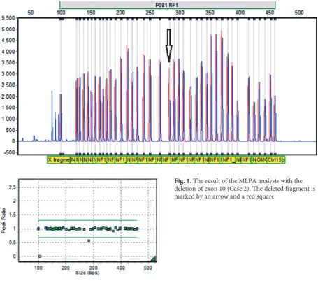 Fig. 1. The result of the MLPA analysis with the deletion of exon 10 (Case 2). The deleted fragment is marked by an arrow and a red square