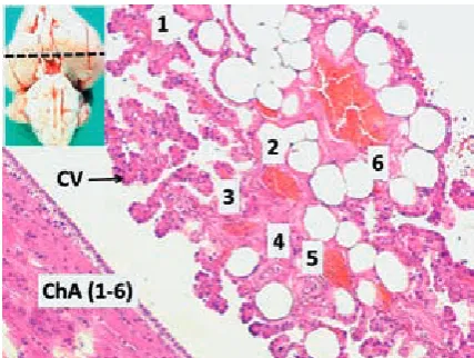 Fig. 1. Normal brain and section level to observe CPs (upper left) and histological appearance of CPs are seen (ChA1-6 – choroidal arteries, CV – choroidal villi of choroidal cells)