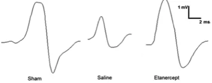 Table 2 Descriptive statistics (mean ± SD) for compound motor action potential parameters studied
