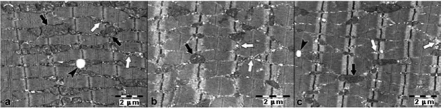 Fig. 4a–c: The gastrocnemius muscle fibers have normal morphological characteristics. a