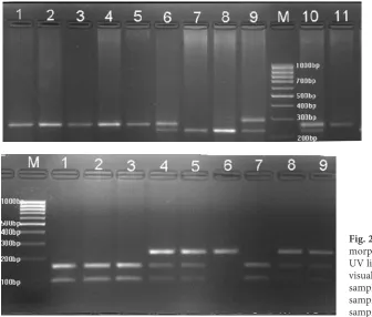 Fig. 2. MAOB gene intron 13 poly-morphism was visualised under 