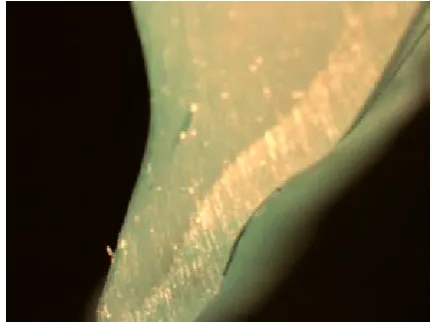 Fig. 7. Visible minor dye penetration into the adhe-sive connection between the light-cured resin and the thermoformable foil (lingual side surface, magnifica-tion ×50)