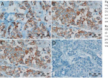 Fig. 1. HER2 IHC stain-ing in CNB (A, C) and 