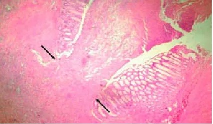 Fig. 1. The figure shows a tissue segment of the anasto-mosis line in the control group (H&E ×40)