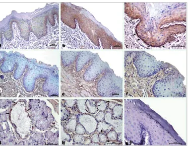 Fig. 2. The representative sections of immunohistochemistry for E-cad and Type IV collagen in all groups