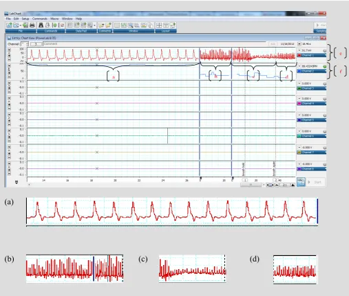 Figure 4 is about the brain signal recorded by Power Lab device according to the activity done by the subject: a) signal in zoom in mode b) signal for normal breathing c) signal when holding breath d) signal when breathing again e) raw data rate f) calculation data rate 
