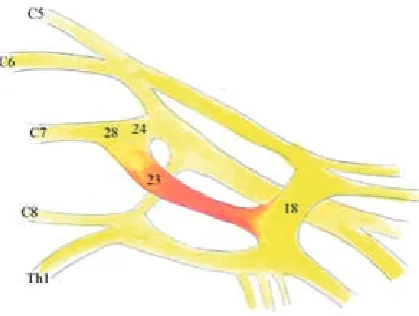 Fig. 5. an additional connection between anterior division of upper trunk (21) and – anterior division of middle trunk (aDMT, 23) – red stars as well as connection between anterior division of middle trunk (23) and medial root of median nerve (12) (figure courtesy of authors)