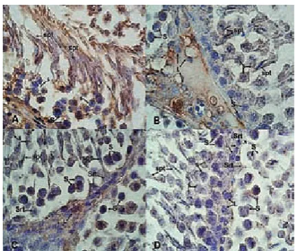 Fig. 3. Klf4 immunostaining: Klf4 expression is strongly observed in spermatogenic cells (spermatogonium – S, spermatocyte – ś, spermatid – spt) and in a remarkable number of Leydig (L) and Sertoli (Srt) cells in the control group (A, B)
