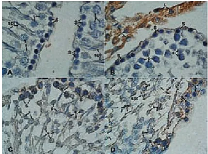 Fig. 4. Sox2 immunostaining. While some of the spermatogonial (S) and Sertoli cells (Srt) showed weak Sox2 expression, there was no staining in the spermatocytes (ś) and spermatids (spt) in the control group