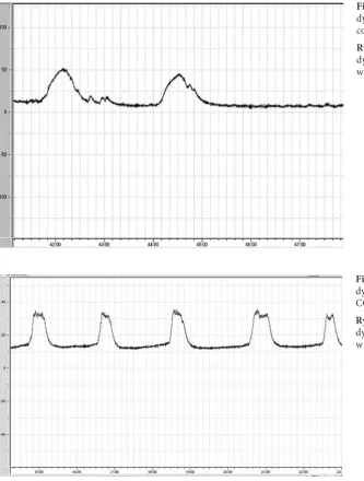 Fig. 1. an example of the uro-dynamic recordings obtained in control rats