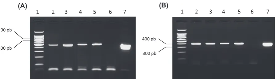 Fig. 5. PcR amplification from experimentally infected clinical samples dNA. (A): Primers B1 and B2, (B): Primers B3 and B4
